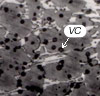 Micro structure